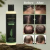 🌱 Organic Rosemary Hair Growth Shampoo